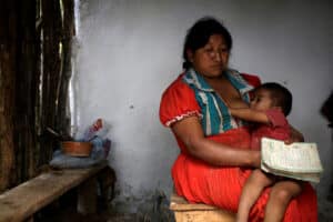 guatemala-malnutrition-2